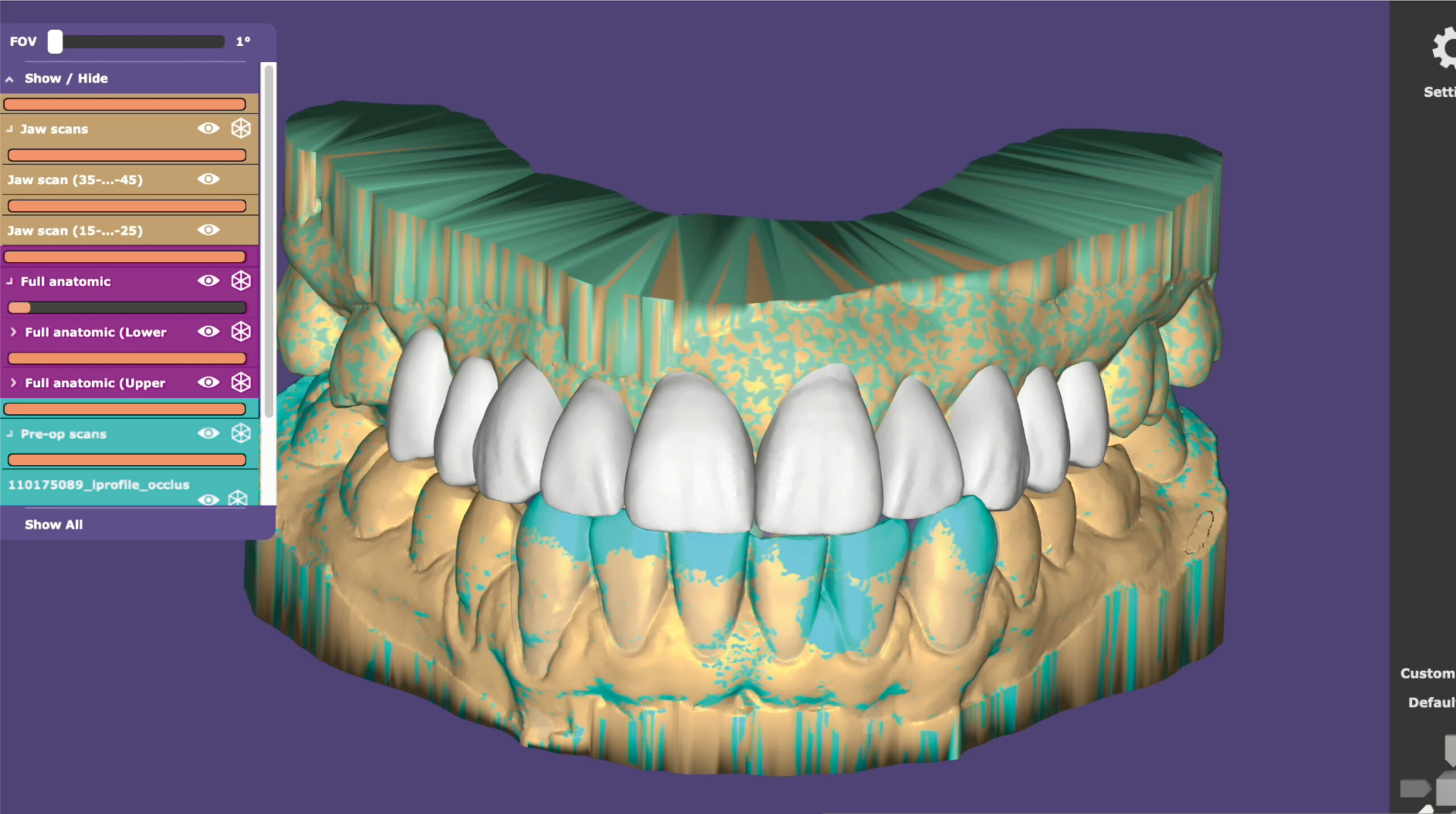 Second Day_TrioClear Align and Restore_Slider_7
