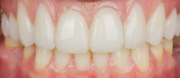 integrative_smile_after_new