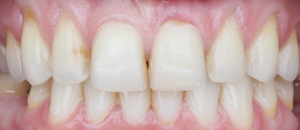 integrative_smile_before_new